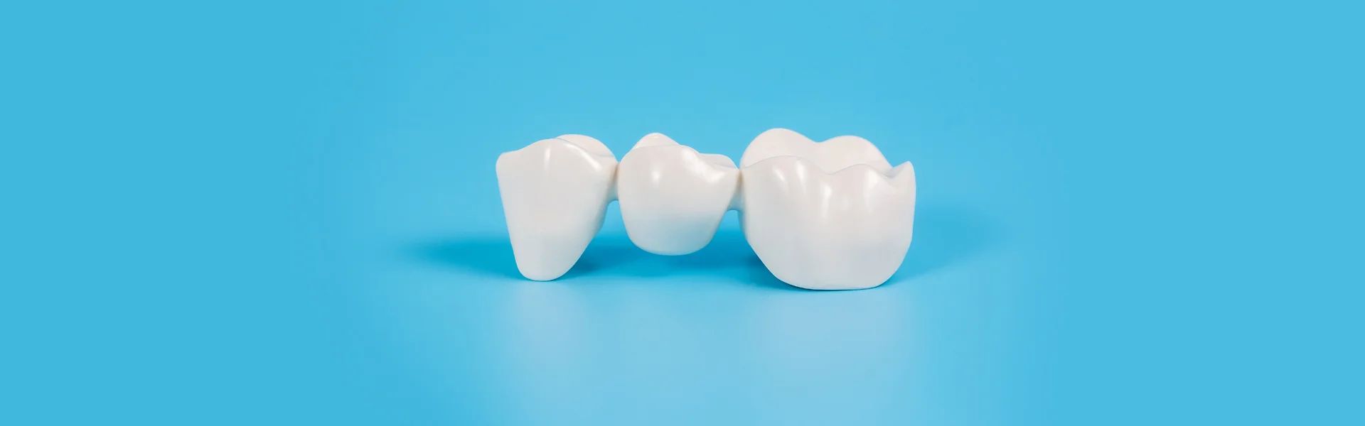 How Do You Clean A Dental Bridge?