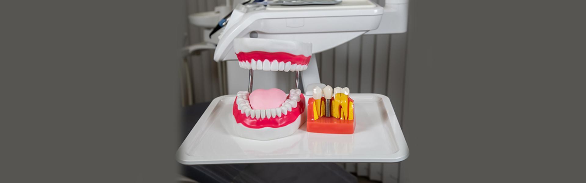 Is Digital Guided Implant Surgery Accurate and Reliable?