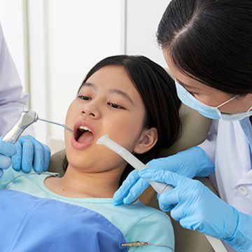 Dental Sealants for Kids: Why They’re Important for Cavity Prevention