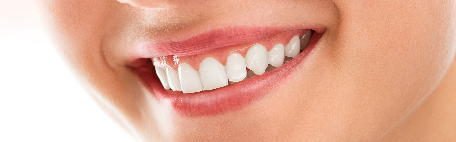 Do Teeth Keep Getting Whiter After Zoom?