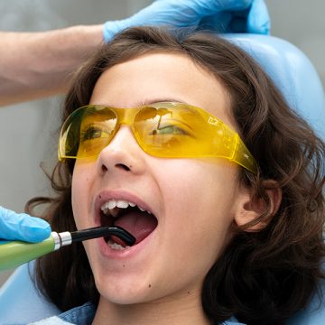 The Step-by-Step Process of Dental Bonding: What to Expect